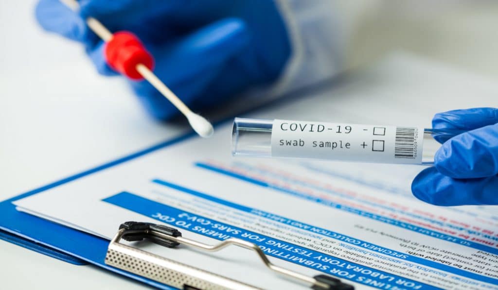 Diferencias entre PCR, test de antígenos y test de anticuerpos rápido
